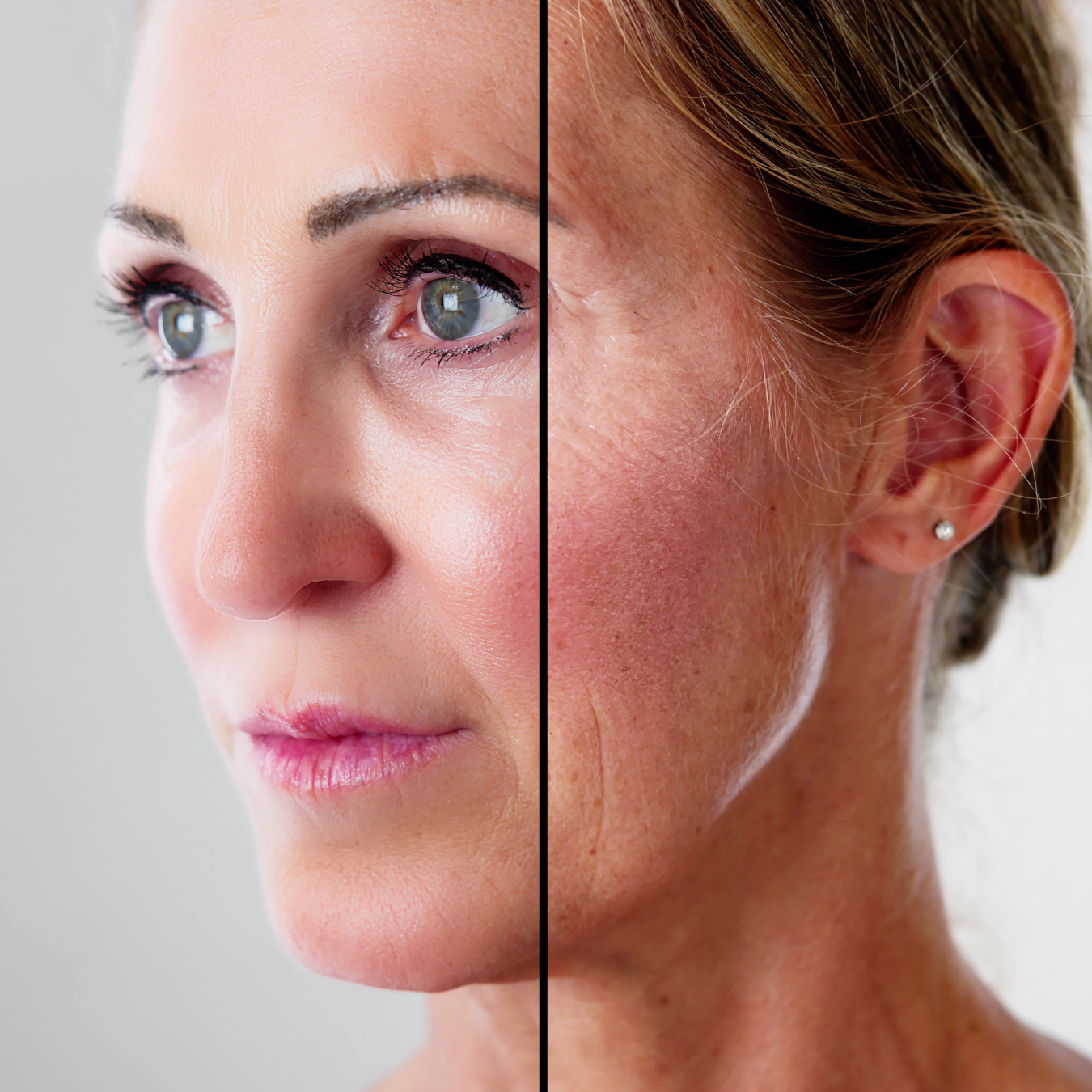 Before and after aesthetic treatment